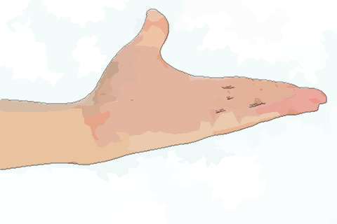 男人双手川字掌什么命有何影响